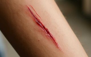 Машину поцарапали на мойке и как забрать деньги за ремонт