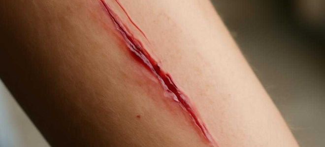 Машину поцарапали на мойке и как забрать деньги за ремонт