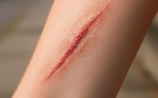 Как убрать царапины с кузова без лишнего ремонта